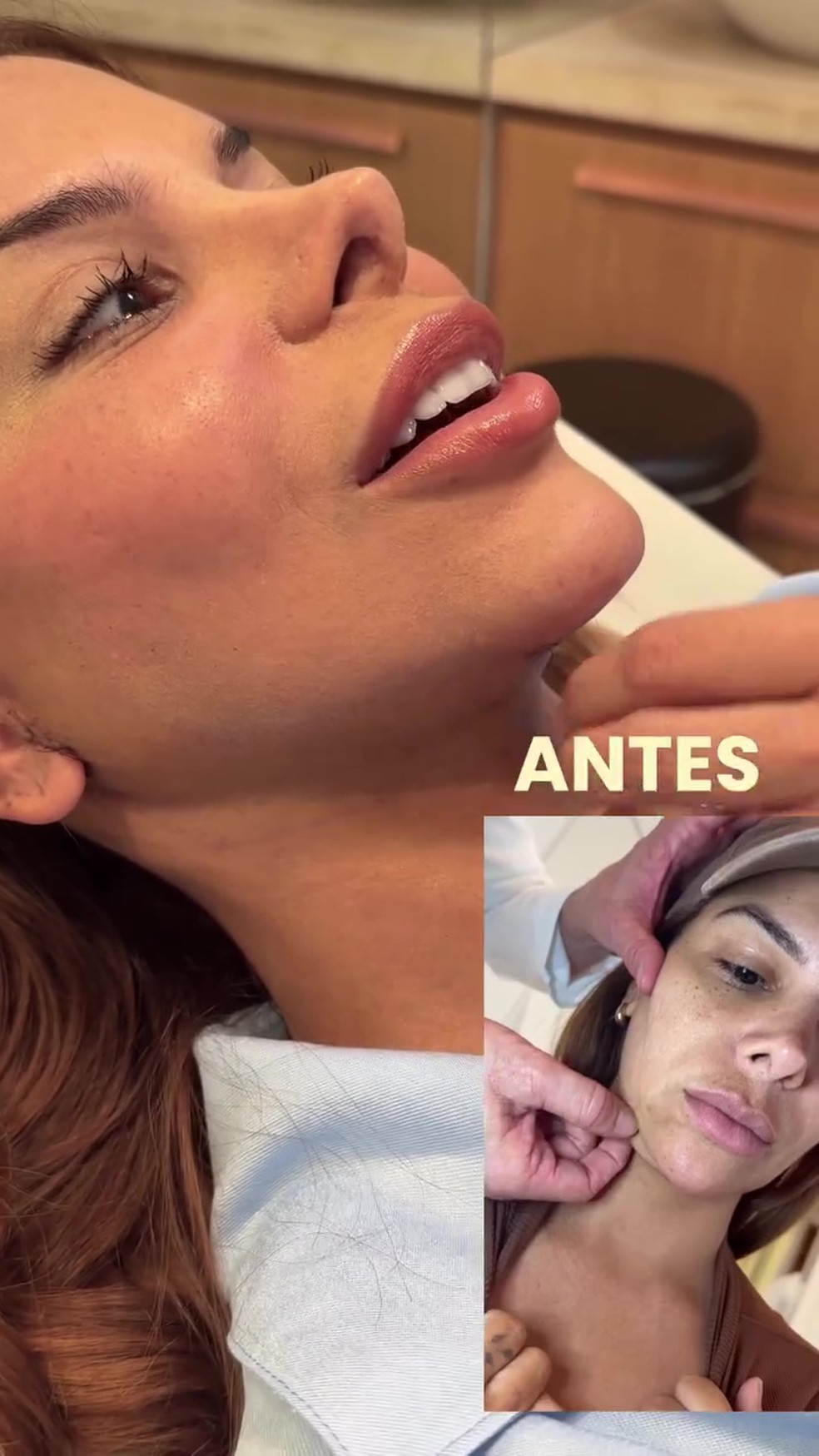 Antes e depois de Evelyn Regly — Foto: Reprodução/Instagram