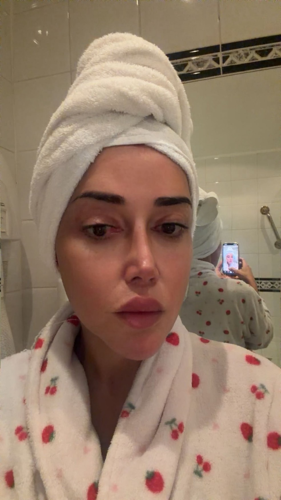 Marcela Porto, a Mulher Abacaxi, depois da feminização facial — Foto: Arquivo pessoal