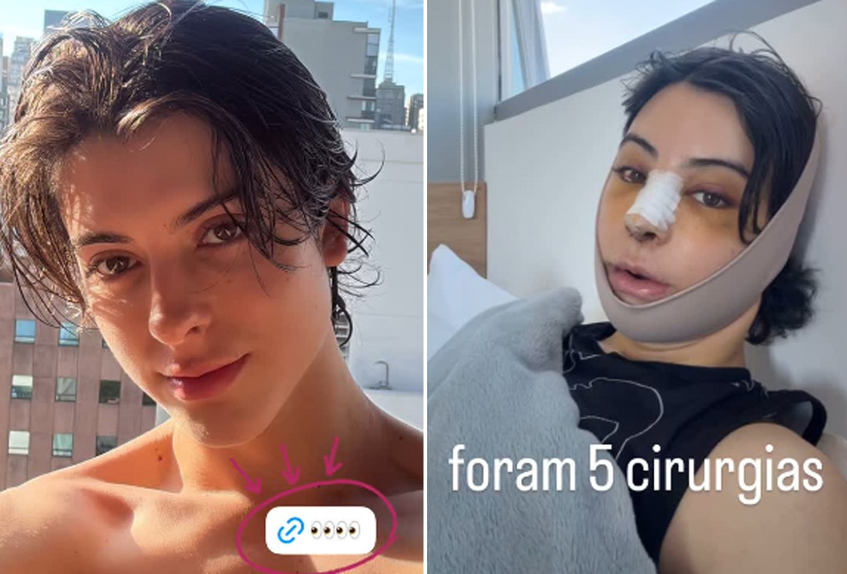 Zé Longuinho diz quantas cirurgias fez na feminização facial e dá detalhes; vídeos - Portais