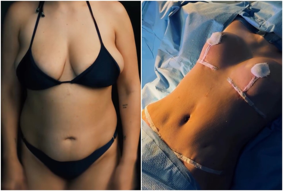 Antes e depois de Camila Moura — Foto: Reprodução/Instagram