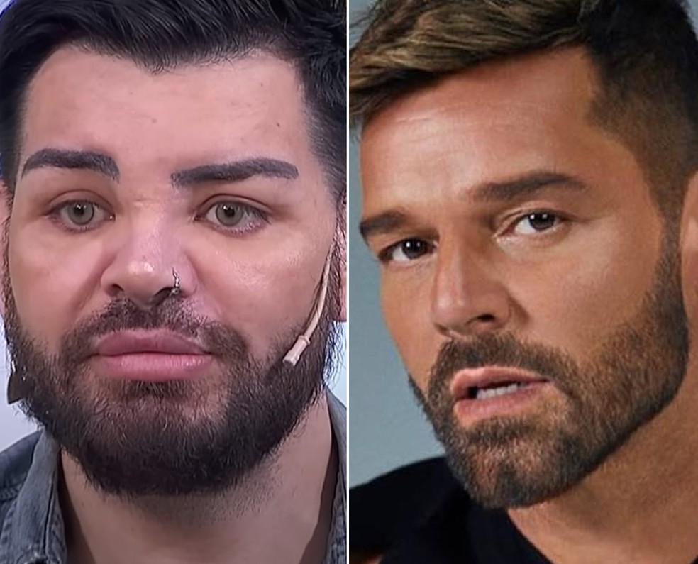Fran Mariano após cirurgias plásticas para se parecer com Ricky Martin — Foto: Instagram e Emmanuel Sanchez Monsalve