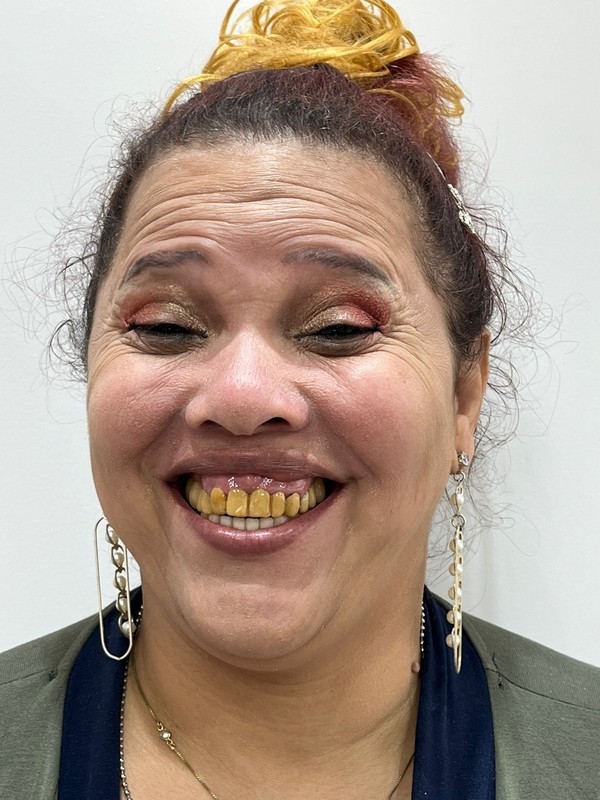Gorete, ex-'Pânico na TV', passa por transformação radical no sorriso ...