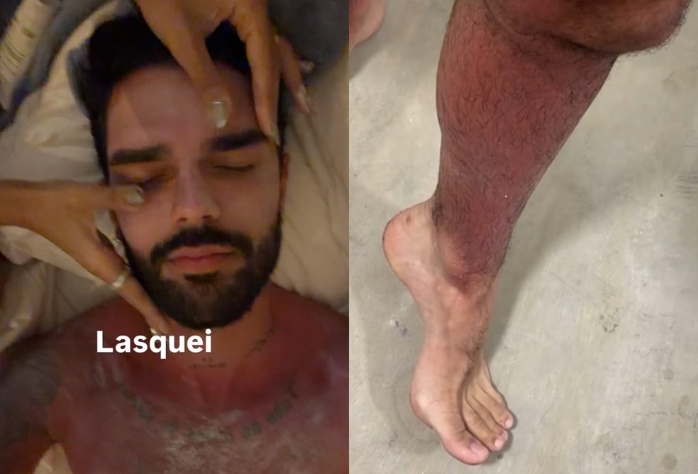 Luan Pereira pega insolação no primeiro dia de viagem a Alagoas e preocupa familiares — Foto: Reprodução/Instagram