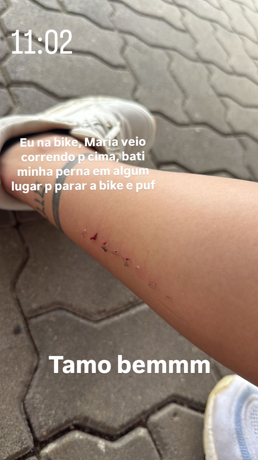 Virginia Fonseca machuca perna durante passeio de bicicleta: 'Maria ...