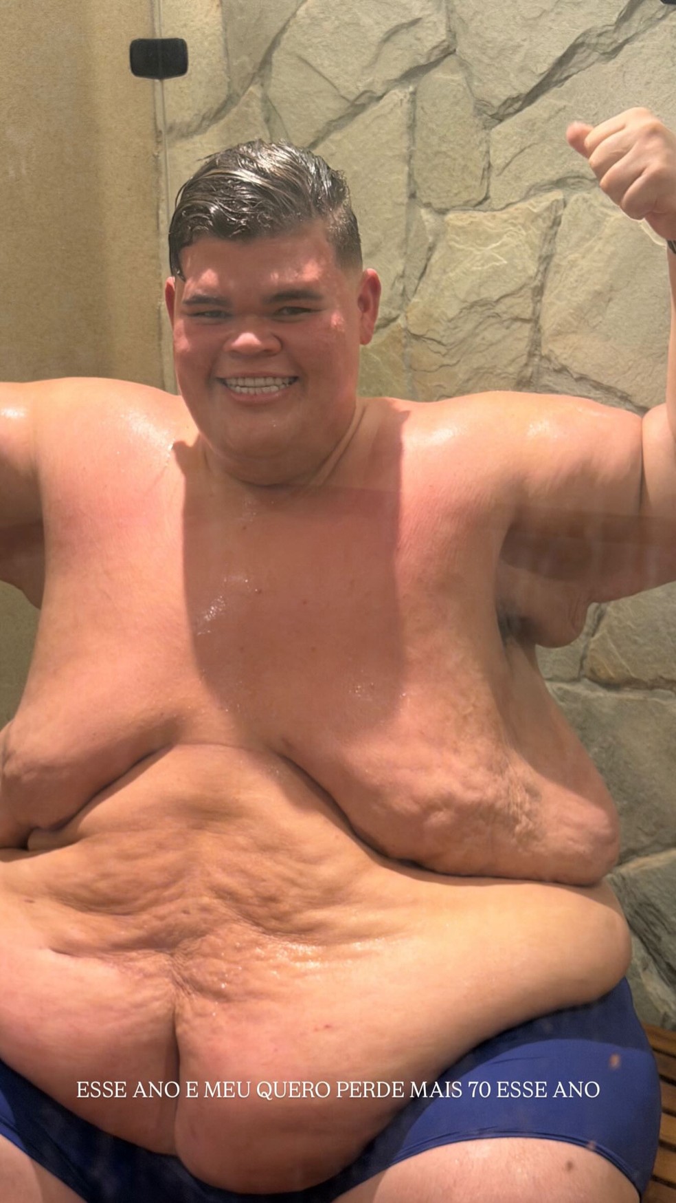 Gordão da XJ atualmente após perder 140 kg — Foto: Reprodução/X
