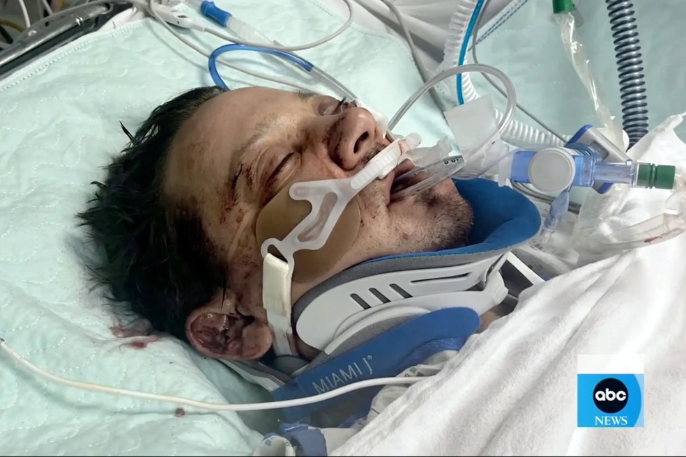 Jeremy Renner chegou no hospital em estado gravíssimo — Foto: Reprodução / ABC