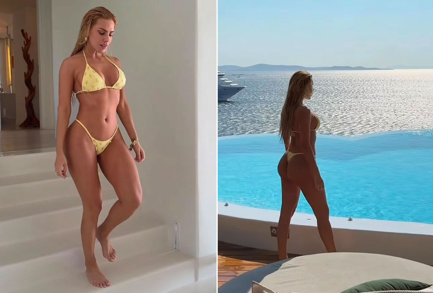Erika Schneider ostenta corpo em Mykonos após procedimento