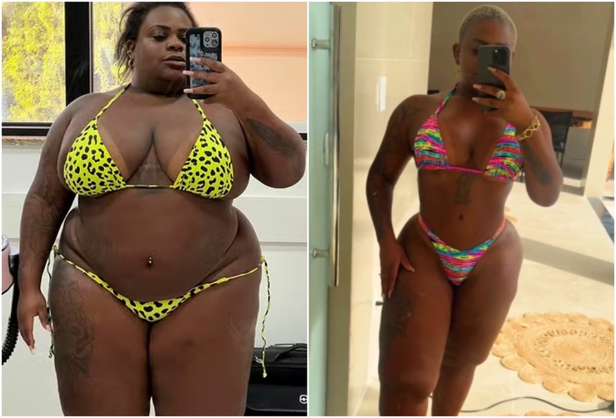 Antes e depois de Jojo Todynho