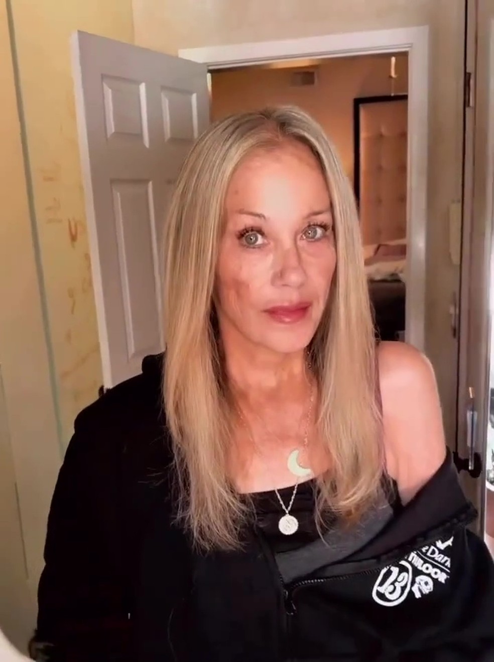 Christina Applegate — Foto: Reprodução/Instagram