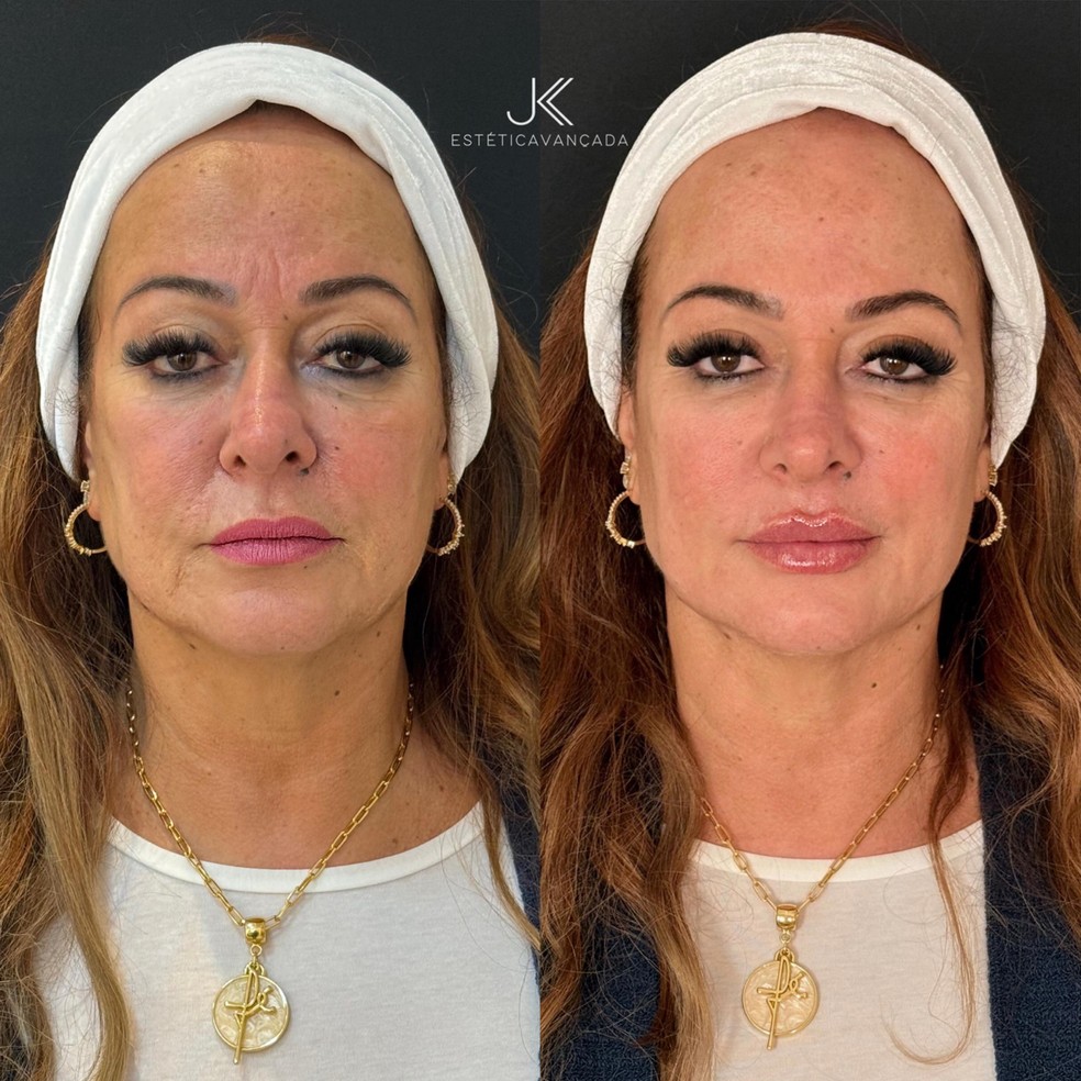 Nadine Gonçalves — Foto: Reprodução/Instagram