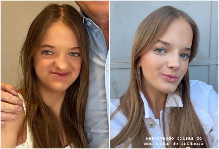 Rafa Justus antes das rinoplastias e atualmente