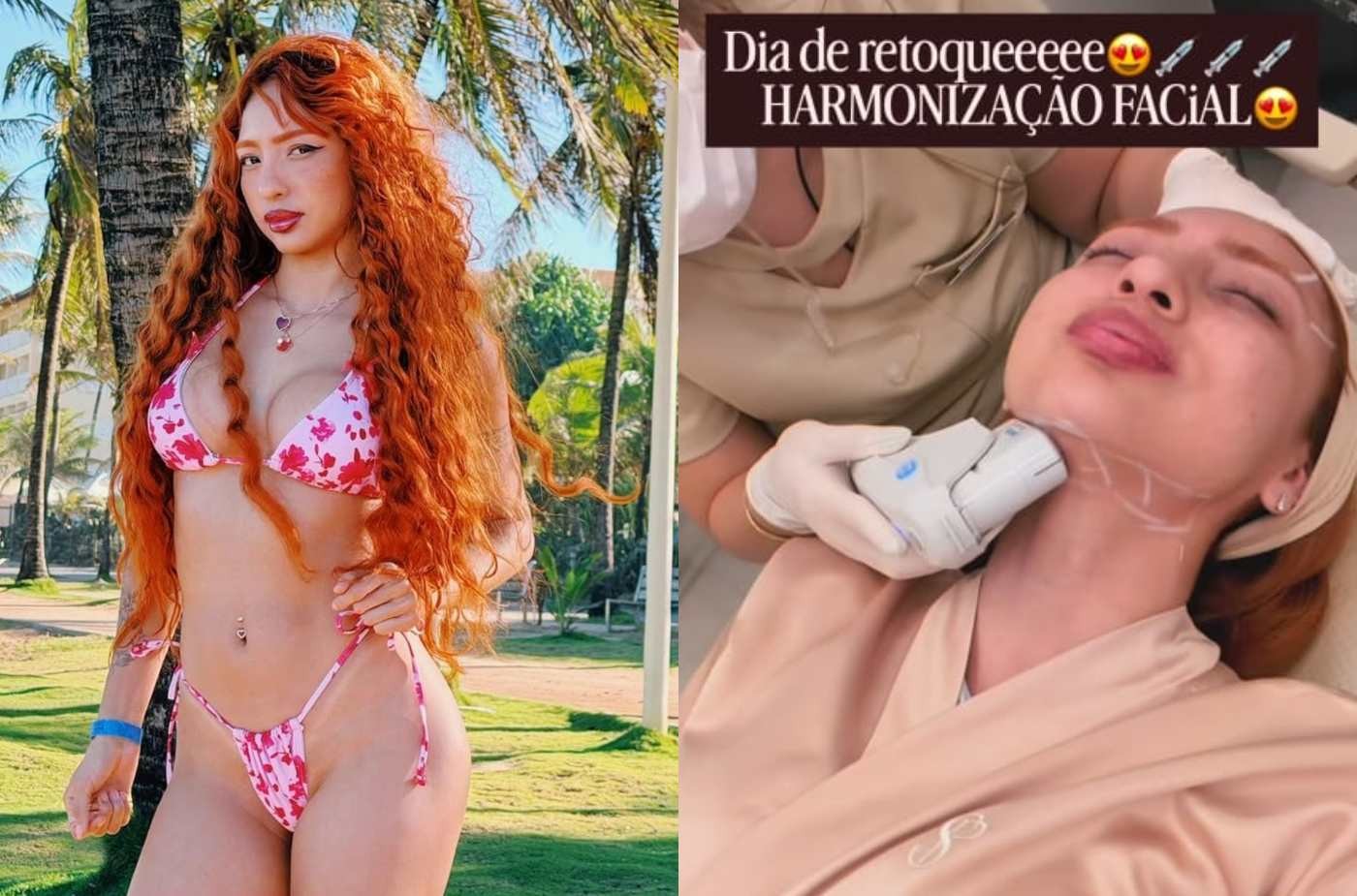 Ruivinha de Marte faz tratamento para papada: 