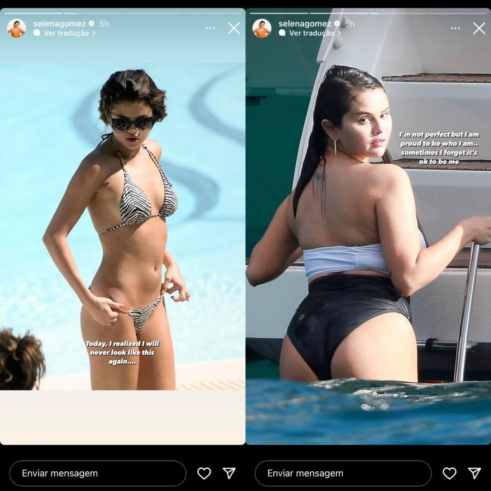Antes e depois de Selena Gomez — Foto: Reprodução/Instagram