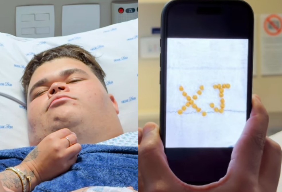 Gordão da XJ fará cirurgia para retirar pedra na vesícula — Foto: Reprodução/Instagram