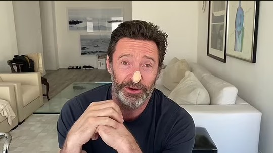 Hugh Jackman, o Wolverine, faz biópsias por suspeita de novo câncer de pele; vídeo