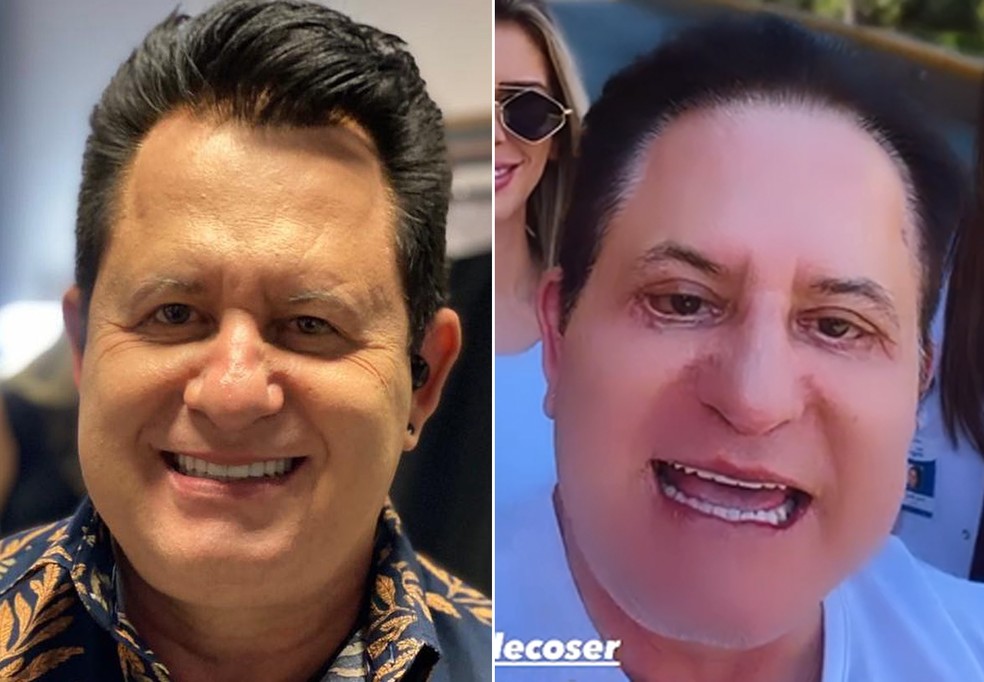 Marrone antes e depois de cirurgia facial — Foto: Reprodução/Instagram