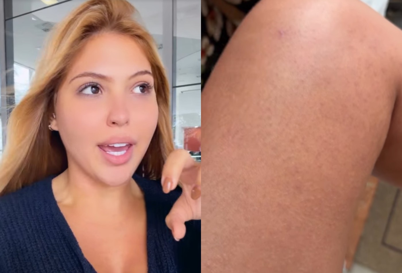 Antes de embarcar para o Rock in Rio, influencer Mariana Menezes é diagnosticada com doença de pele - QTU Questões do Universo
