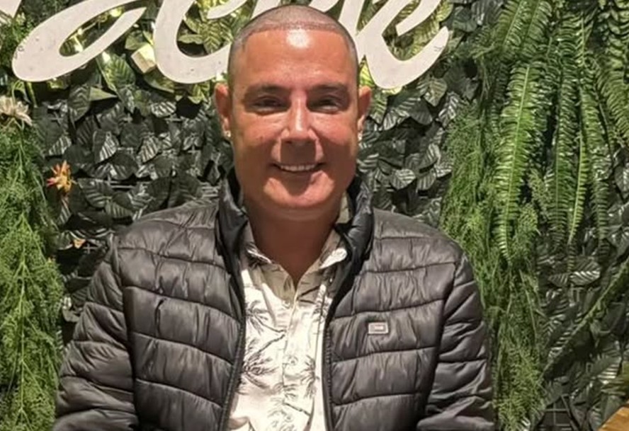 Após harmonização facial, Vavá faz transplante capilar e posa com filho