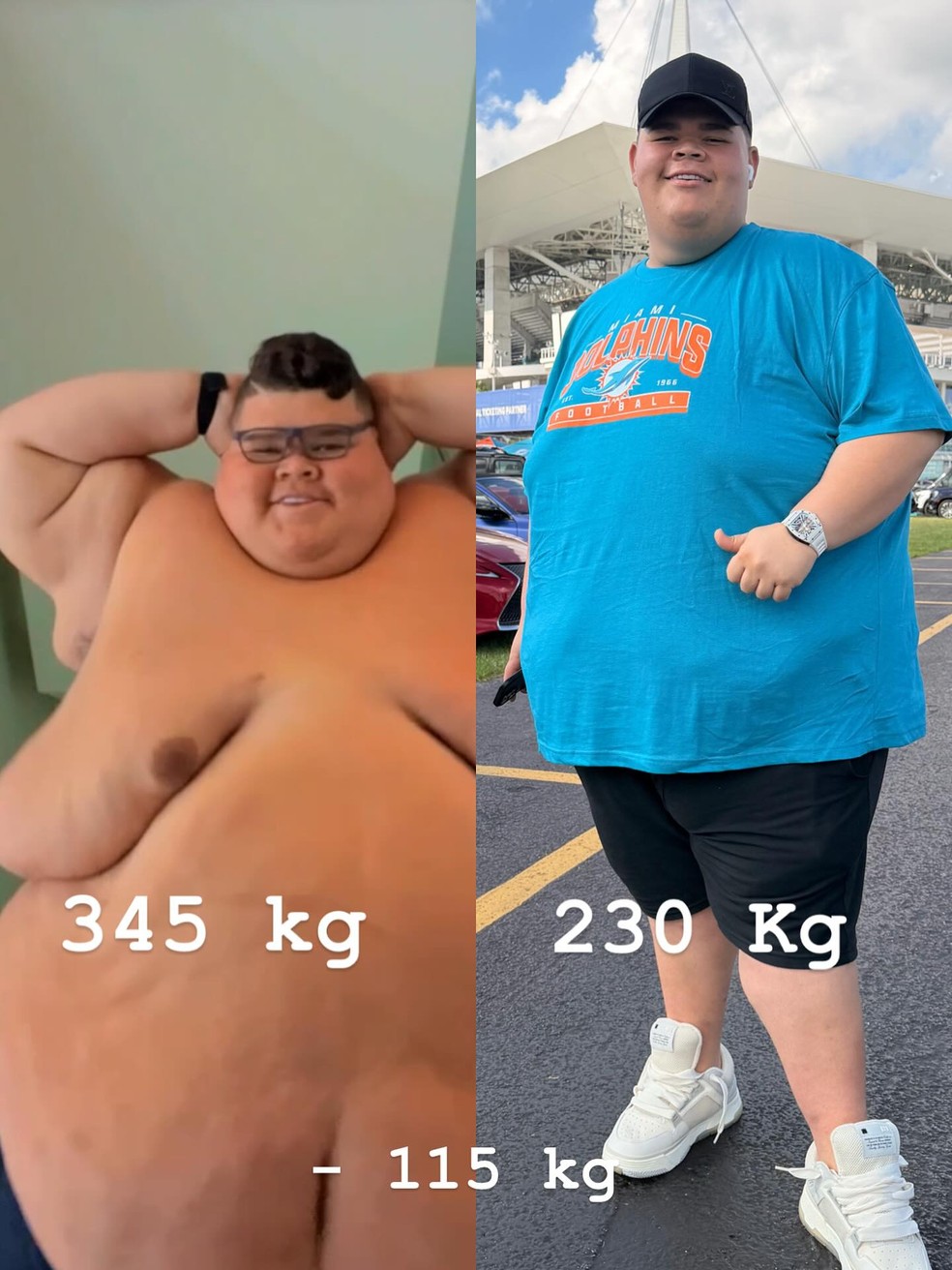 Gordão da XJ mostra antes e depois — Foto: Reprodução/Instagram