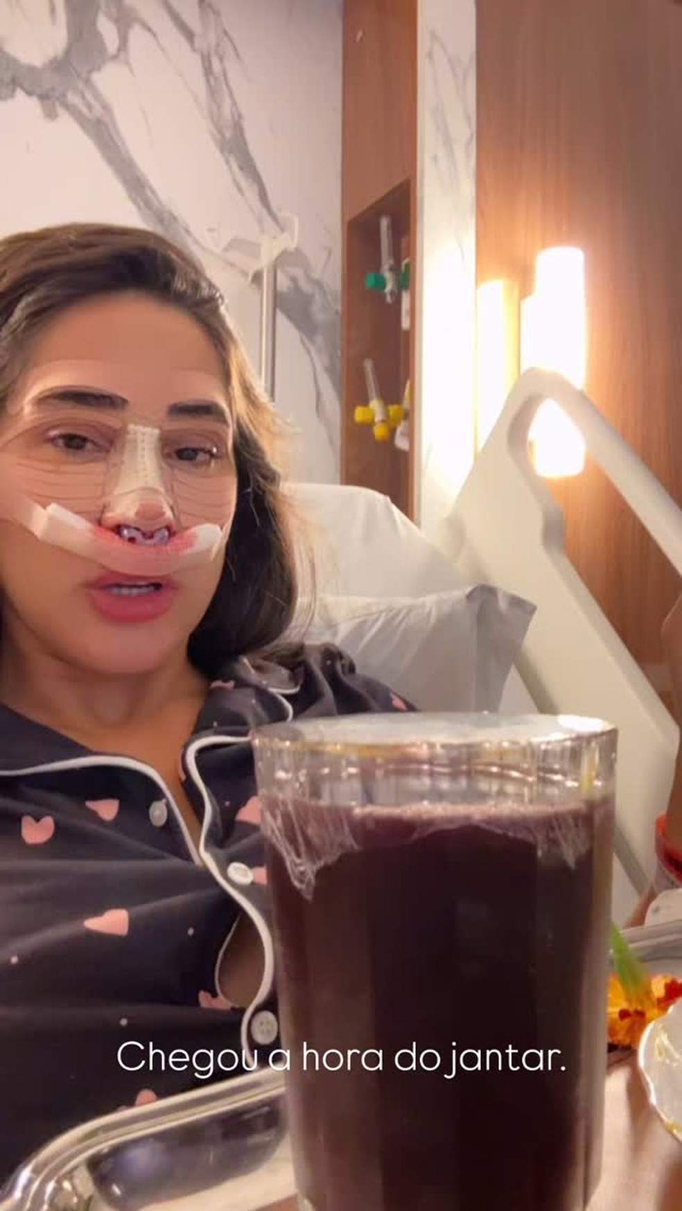 Deniziane após rinoplastia — Foto: Reprodução/Instagram