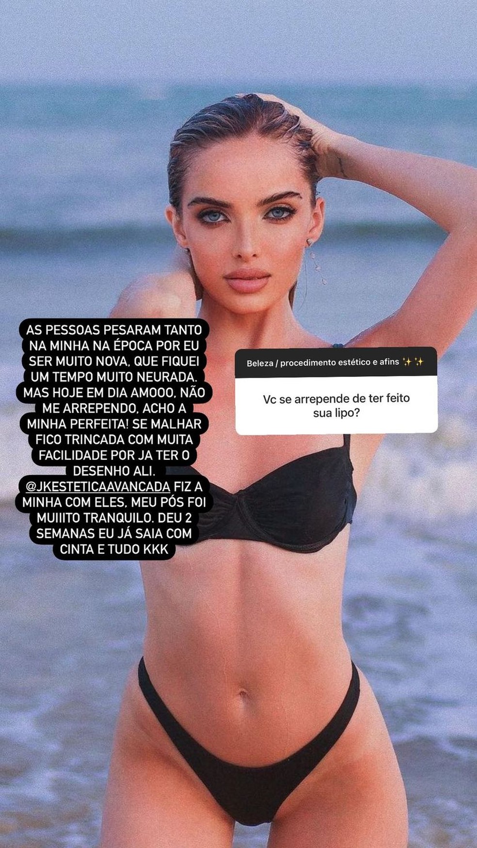 Story de Giovanna Chaves — Foto: Reprodução/Instagram