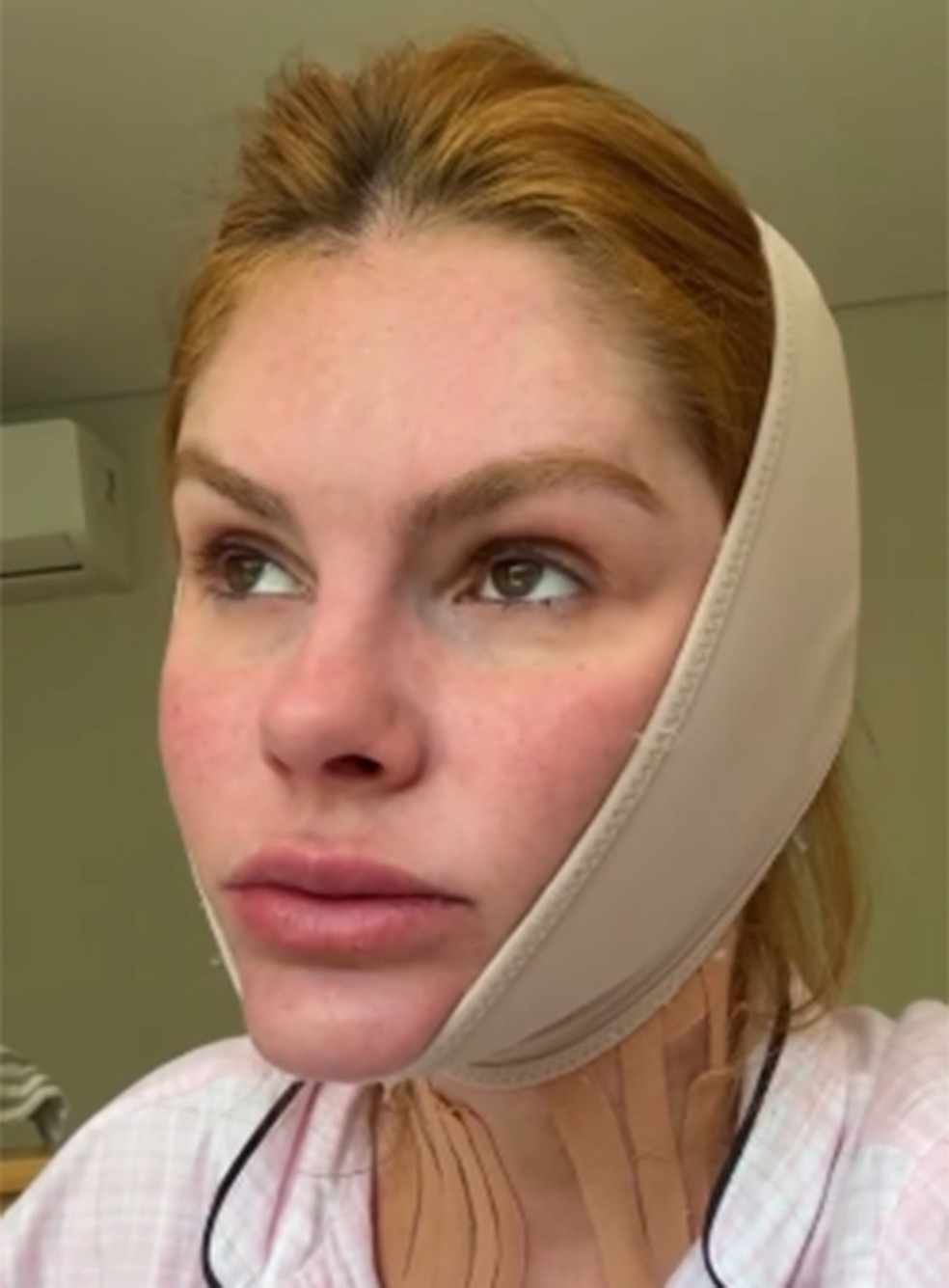 Bárbara Evans recorre a técnica para diminuir papada — Foto: Reprodução/Instagram