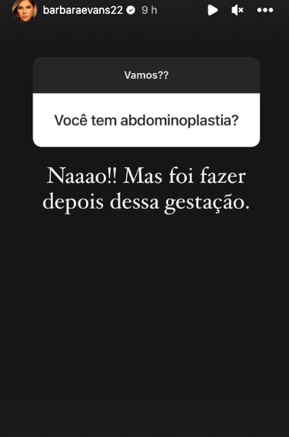 Bárbara Evans revela que fará abdominoplastia — Foto: Reprodução