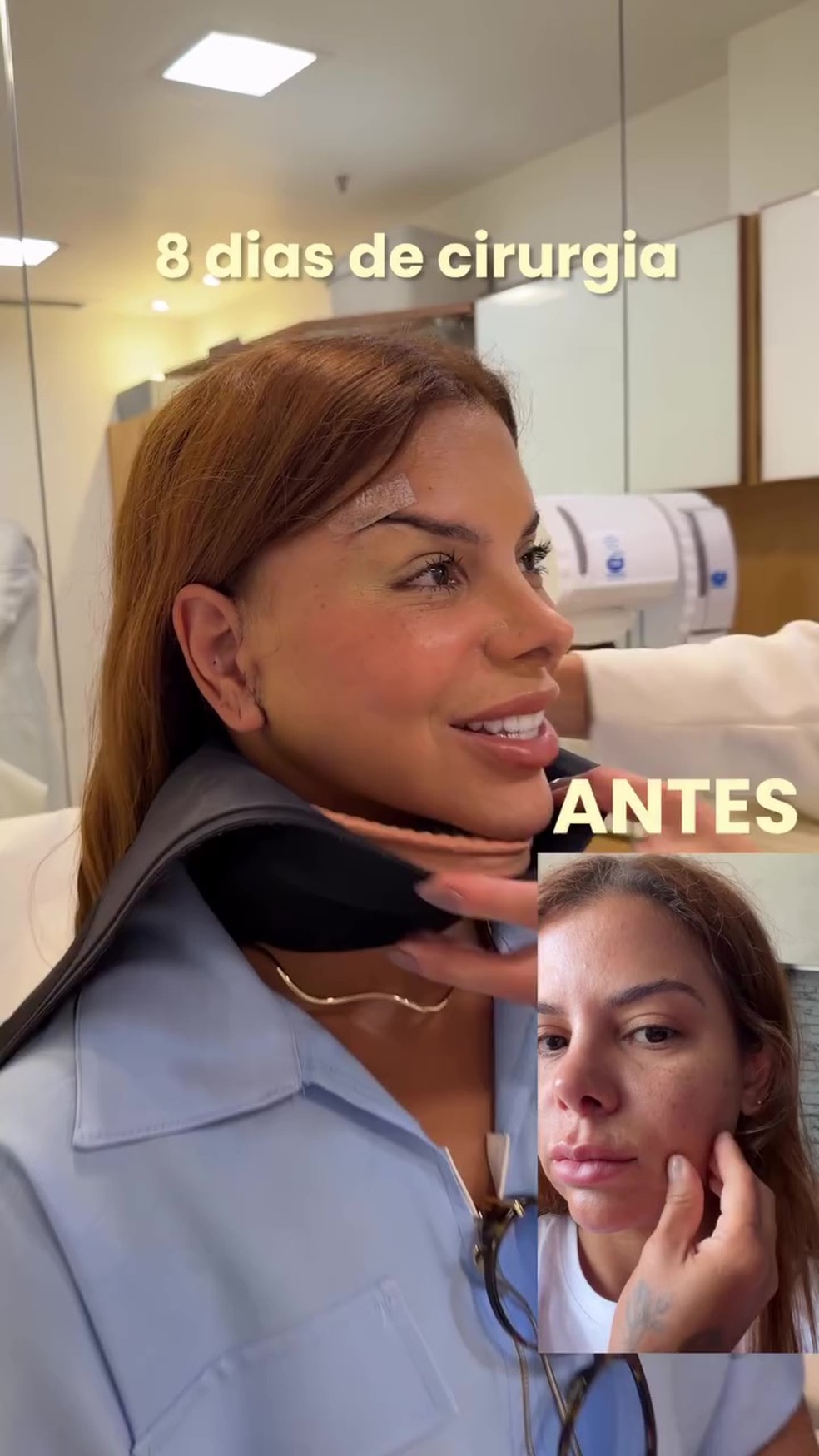 Antes e depois de Evelyn Regly — Foto: Reprodução/Instagram