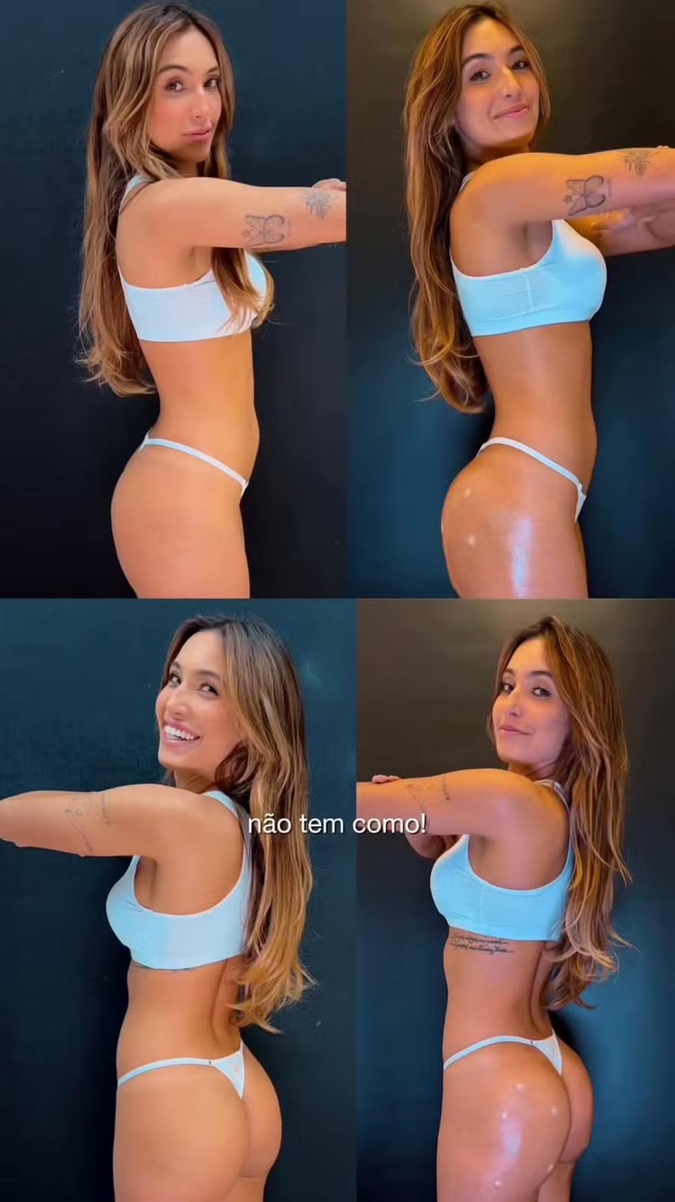 Vanessa Lopes antes e depois do tratamento — Foto: Reprodução/Instagram