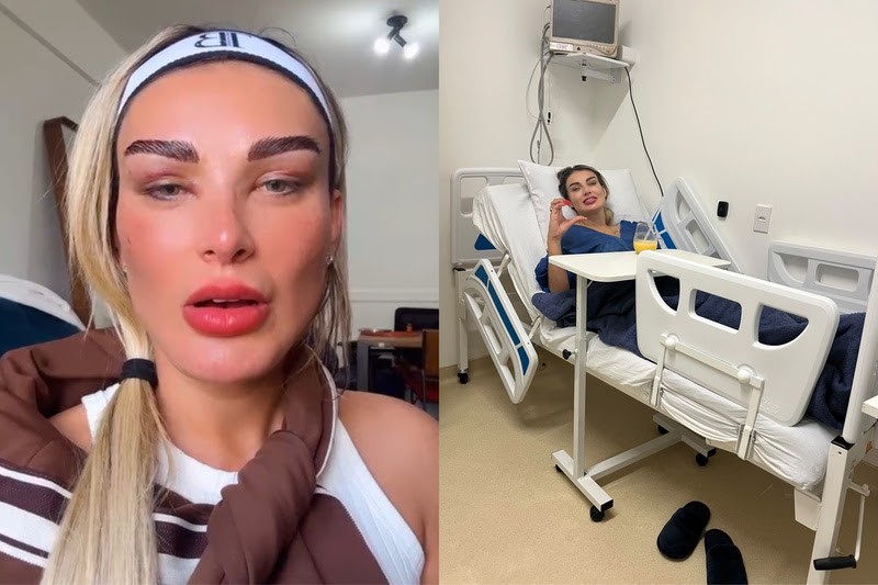 Andressa Urach passa pela 69ª cirurgia ao fazer transplante de sobrancelha: 'Era um sonho'