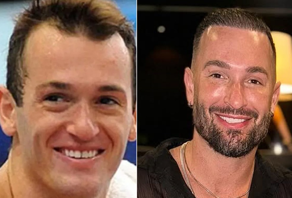 O antes e depois de Deigo Hypolito — Foto: Reprodução Instagram