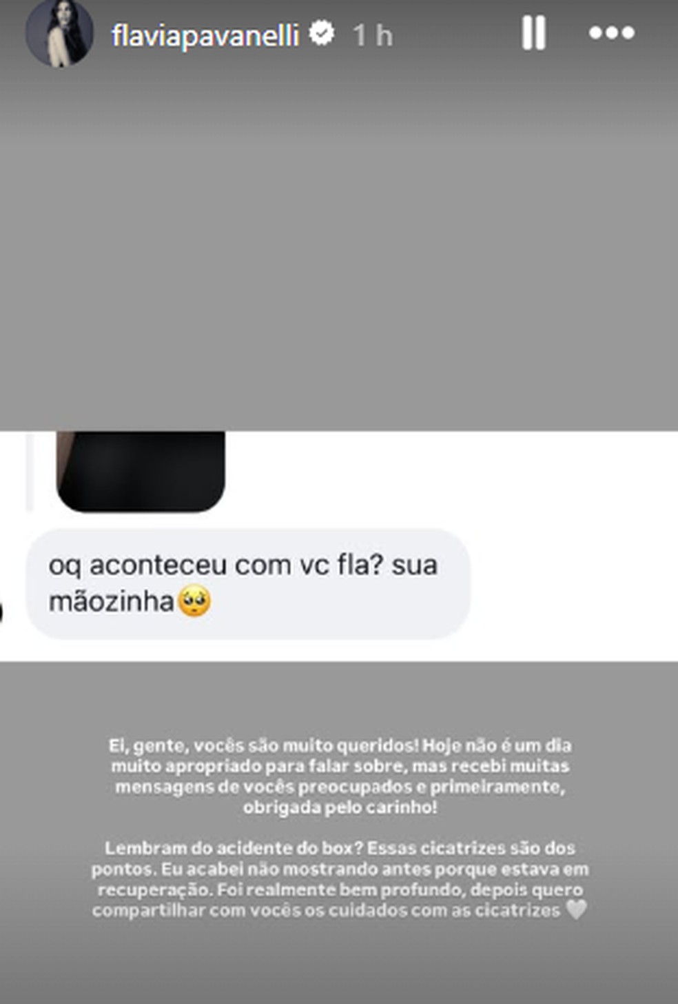 Flavia Pavanelli explica cicatrizes na mão — Foto: Reprodução/Instagram