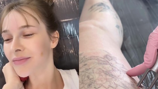 Sammy Sampaio passa por remoção de tatuagens a laser: 'Devia ter escutado meu pai'