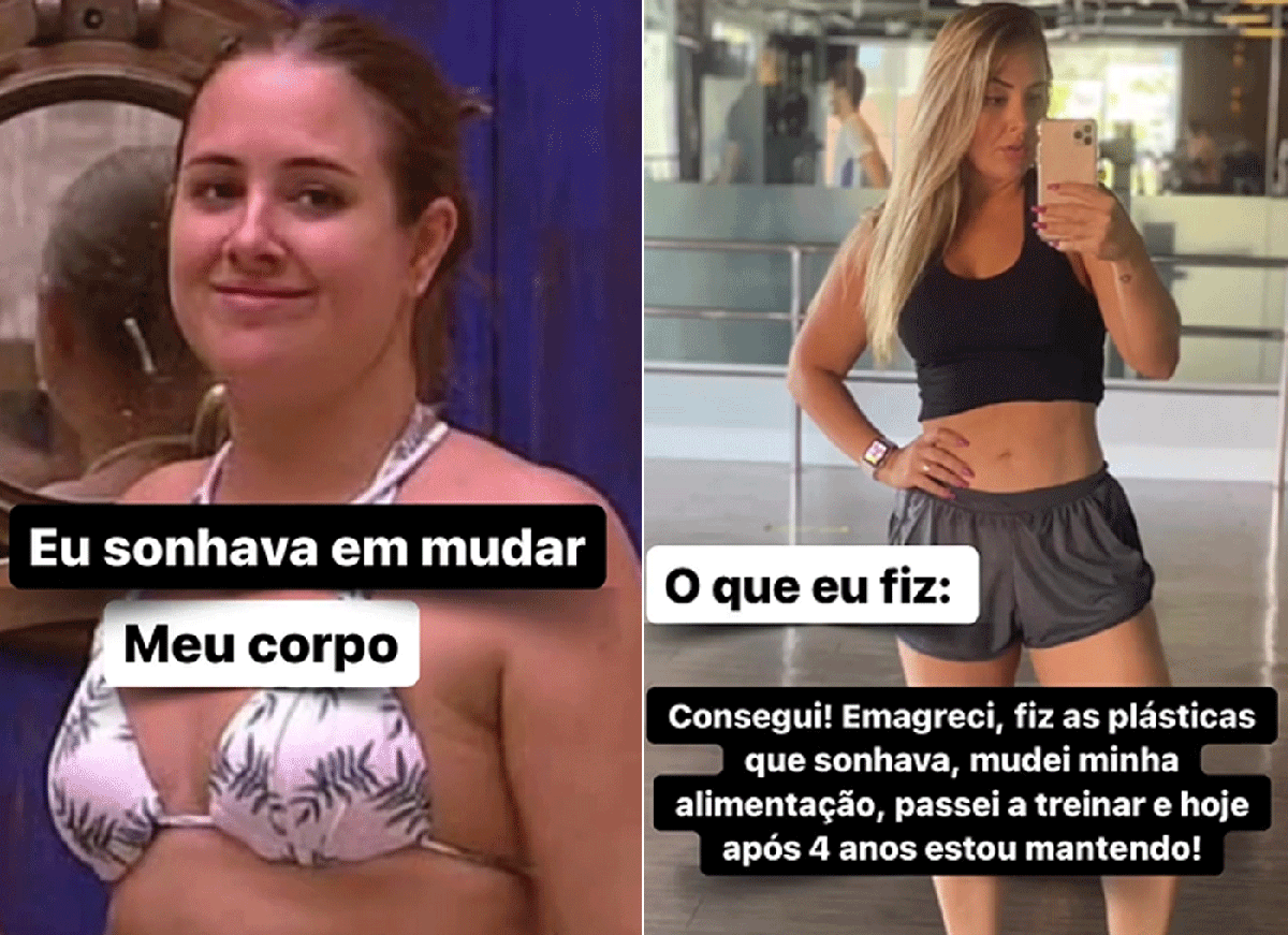 Gracyanne tem silicone na bunda