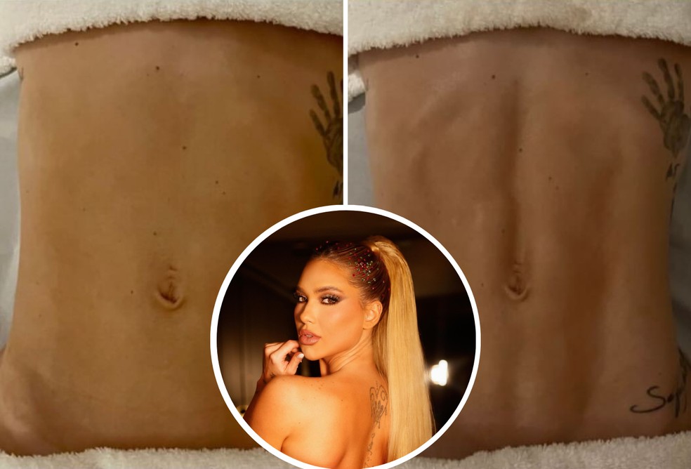 Virginia Fonseca antes e depois — Foto: Reprodução/Instagram