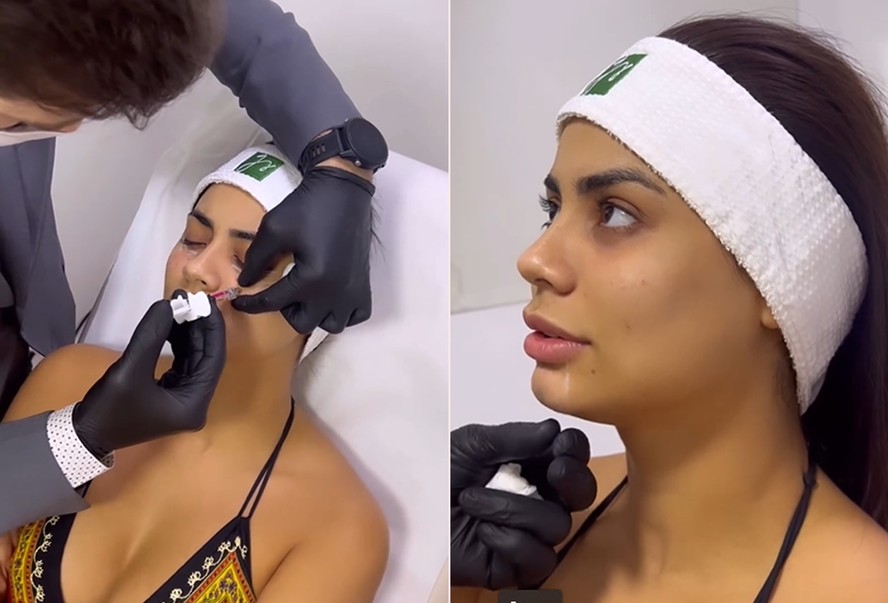 Lexa faz preenchimento no rosto e procedimento no bumbum; vídeo