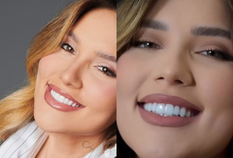 Antes e depois de Virginia Fonseca — Foto: Reprodução/Instagram