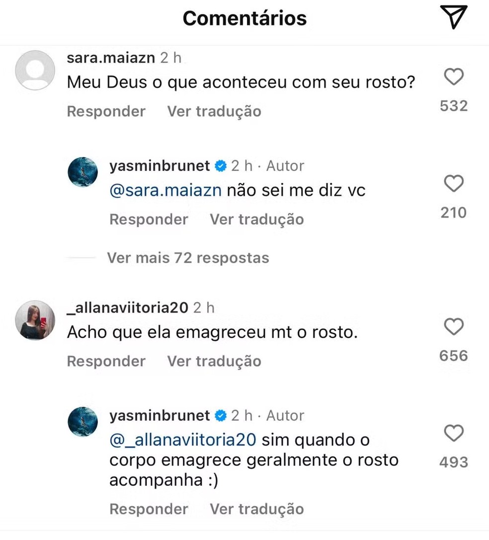Yasmin Brunet rebate comentários sobre seu rosto — Foto: Reprodução/Instagram