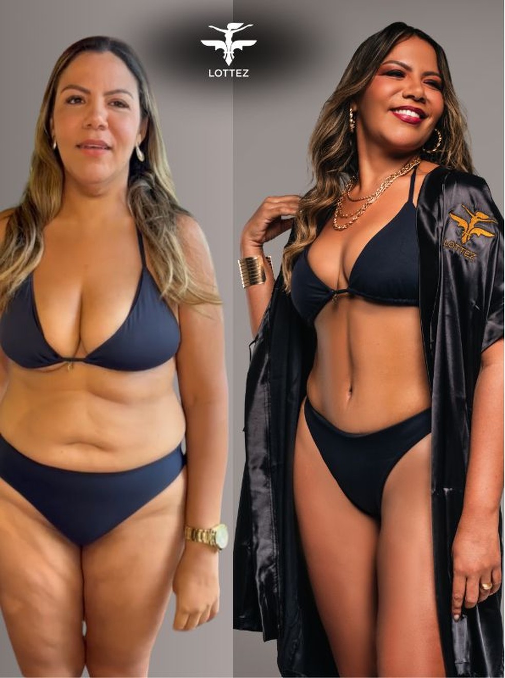 Mani Reggo antes e depois de cirurgia plástica — Foto: Reprodução