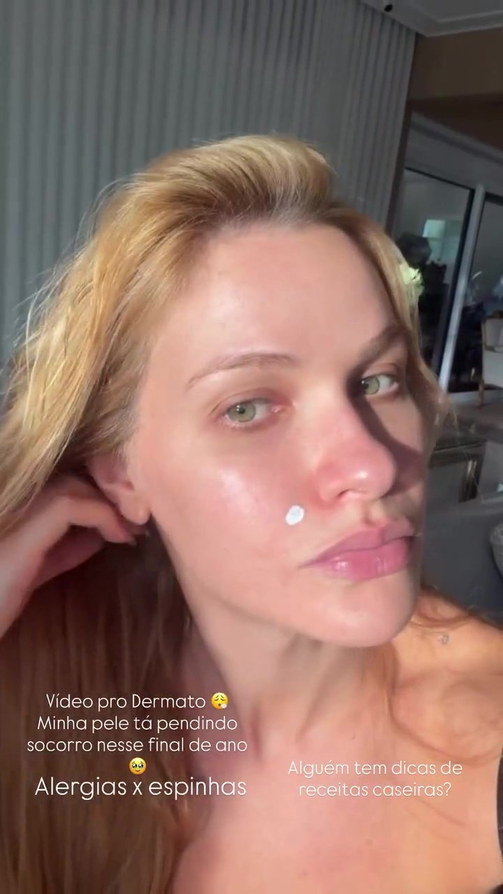 Andressa Suita reclama de 'pele ruim' e fala de tentativa de engravidar — Foto: Reprodução/Instagram