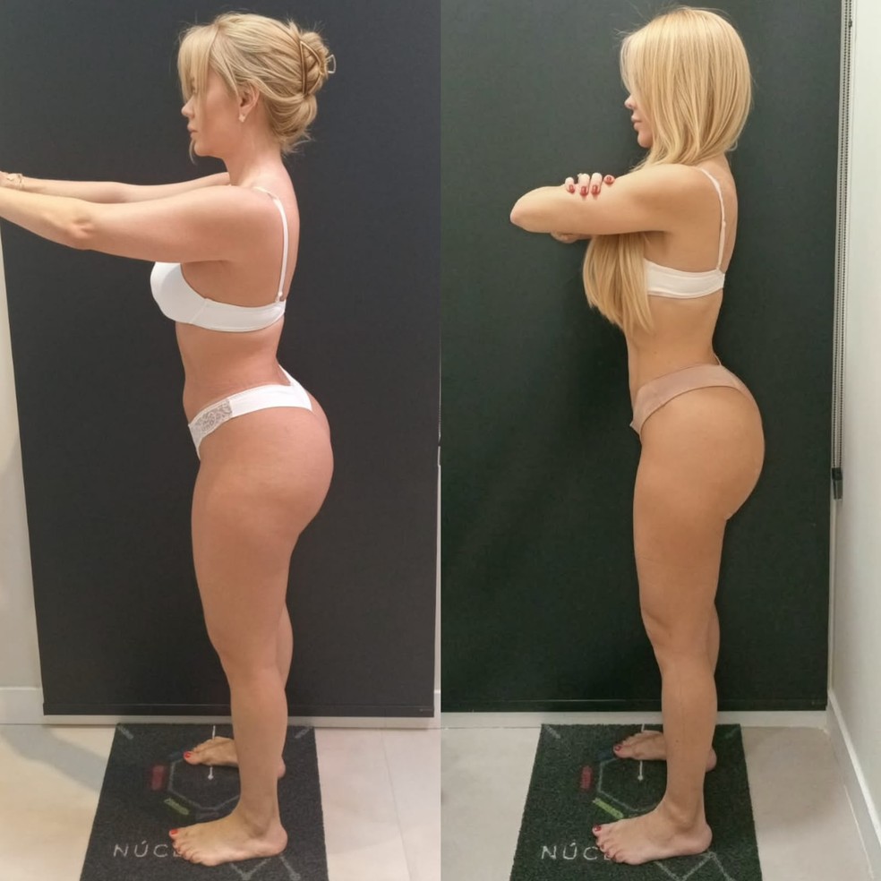 Denise Dias: antes e depois — Foto: Divulgação