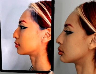 Sarah, ex-BBB, faz harmonização facial e transforma seu rosto; confira -  Comportamento