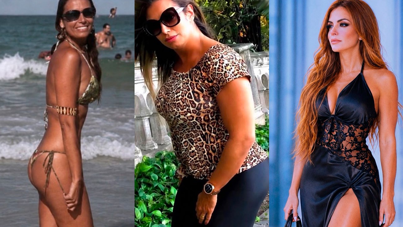 Miss América fala de diagnóstico de três doenças crônicas e pressão estética