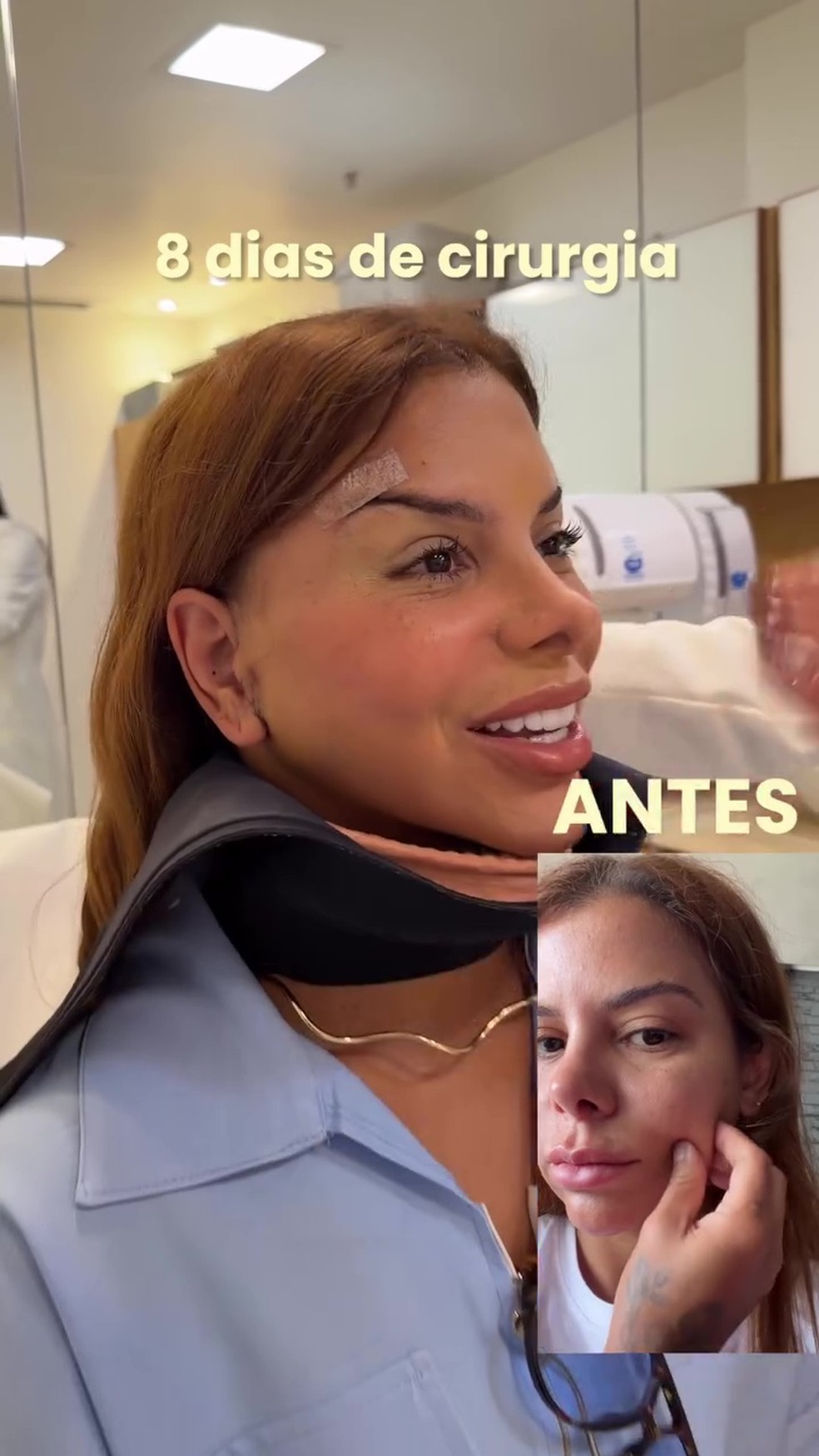 Antes e depois de Evelyn Regly — Foto: Reprodução/Instagram