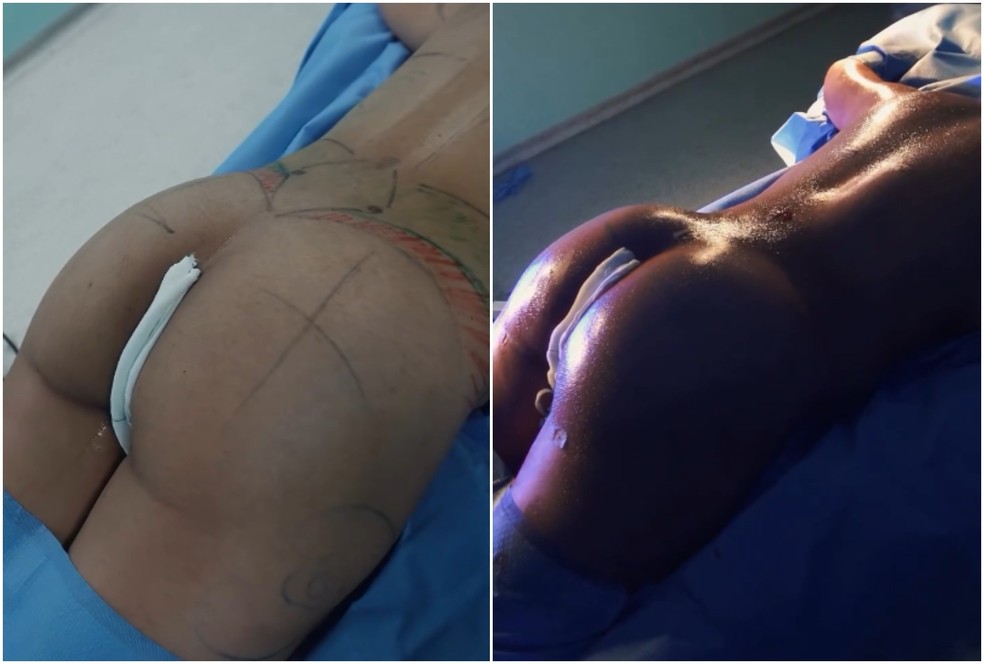 Antes e depois de Camila Moura — Foto: Reprodução/Instagram