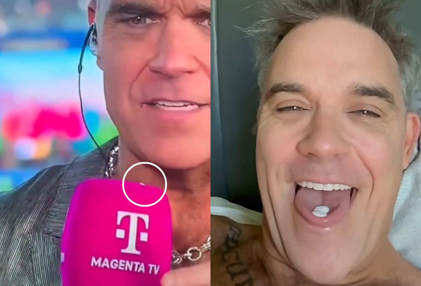 Robbie Williams e o objeto branco: quando o espetáculo vira crise