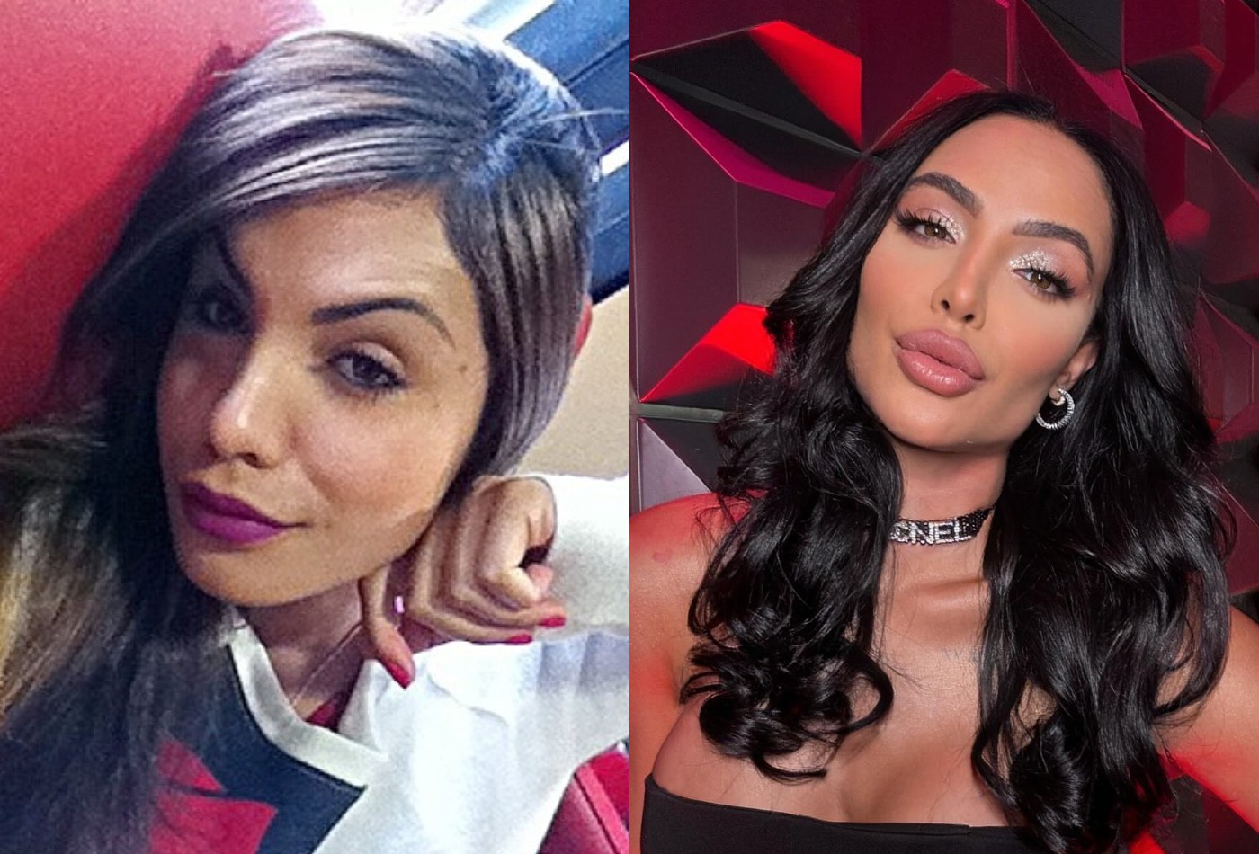 Aline Mineiro surpreende com antes e depois de procedimentos estéticos