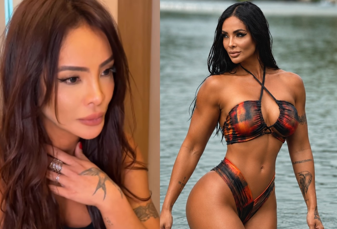 Carol Nakamura faz sessão de laser de colágeno vaginal para 