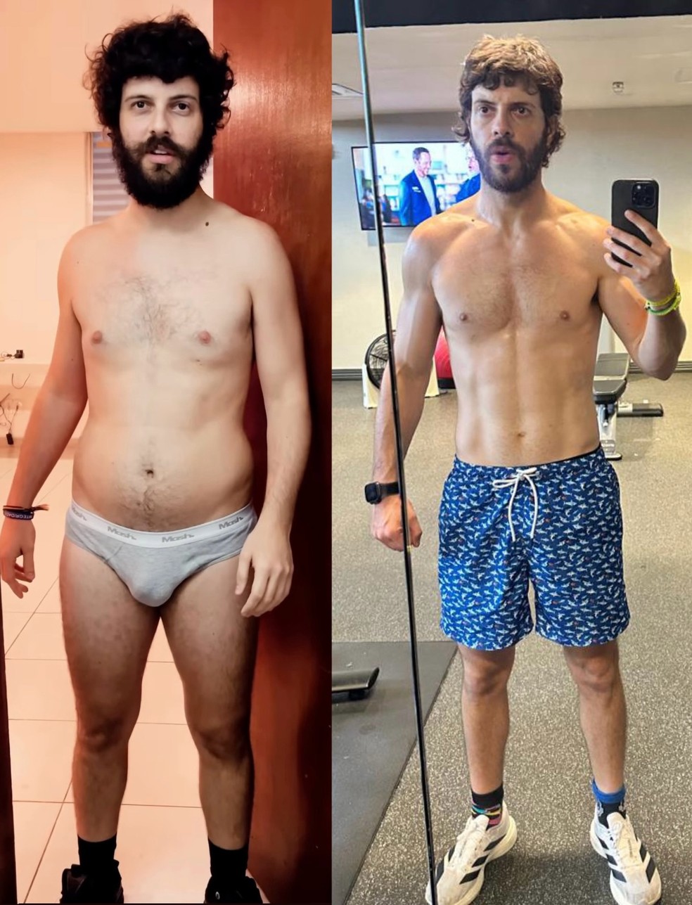 Antes e depois de Diogo Defante — Foto: Reprodução/Instagram