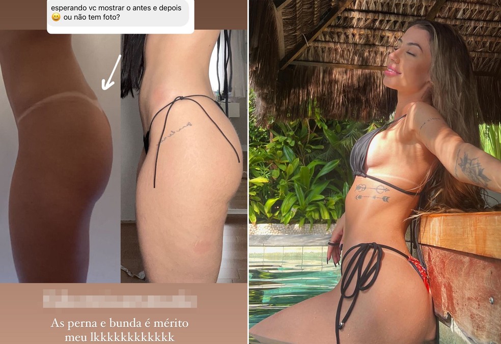 Maria Lina mostra antes e depois dee cirurgias plásticas — Foto: Instagram